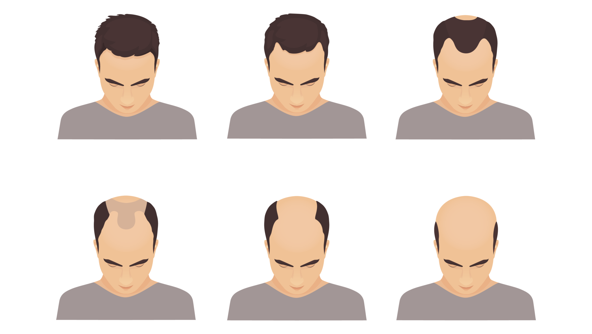 QUEDA DE CABELO CAUSAS E TRATAMENTOS Ada Tina