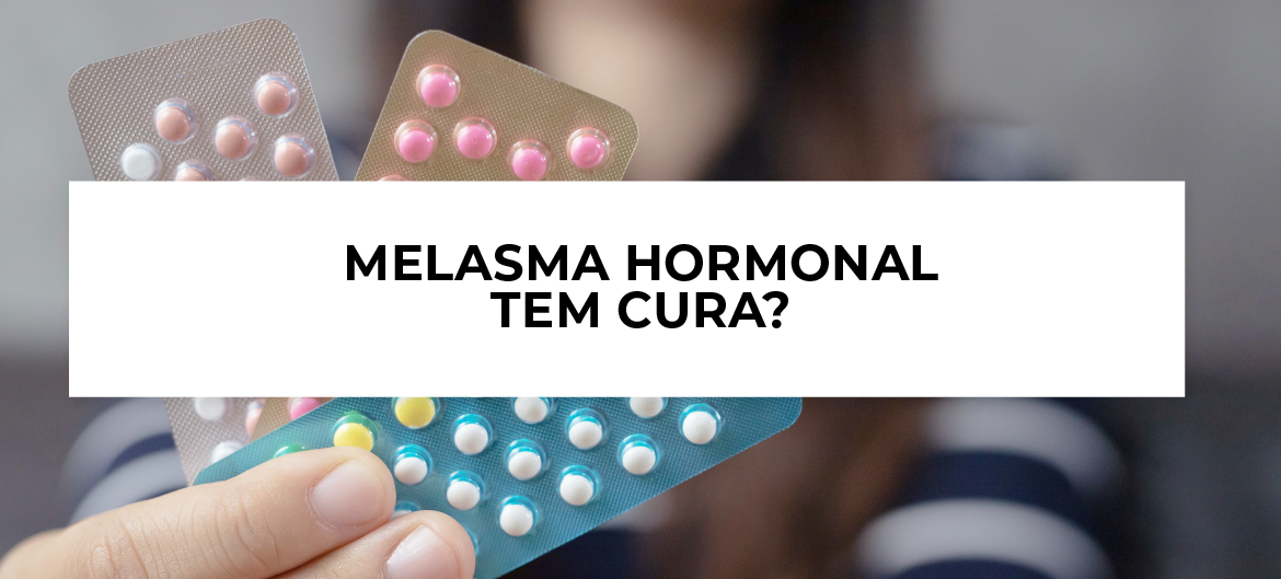 melasma hormonal tem cura?