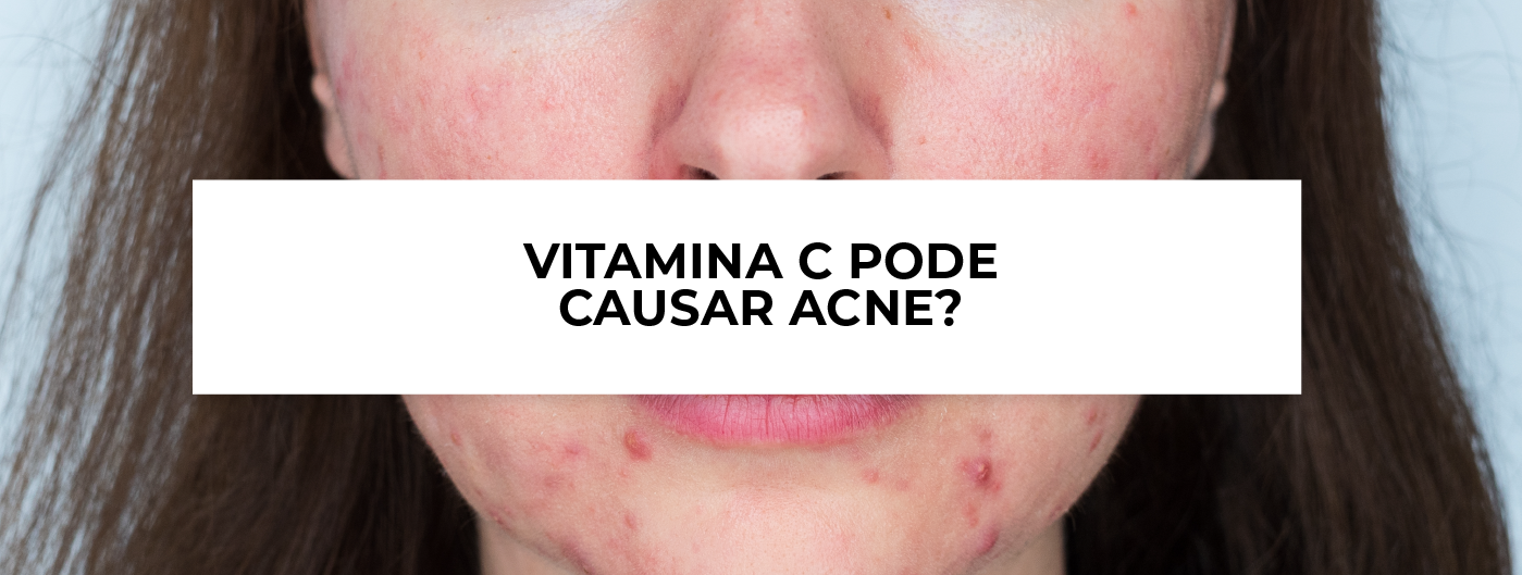 Vitamina C pode causar acne? - Blog Ada Tina