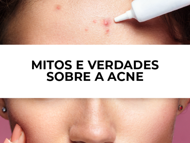 mitos e verdades sobre a acne