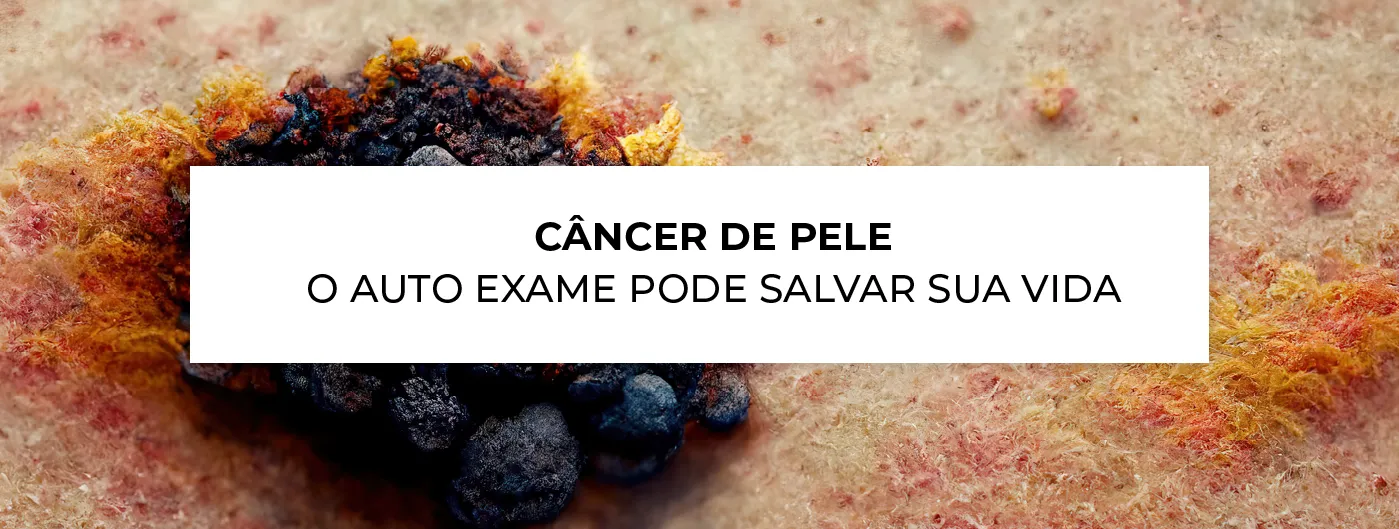 Câncer de pele: O auto exame pode mudar a sua vida! - Blog Ada Tina